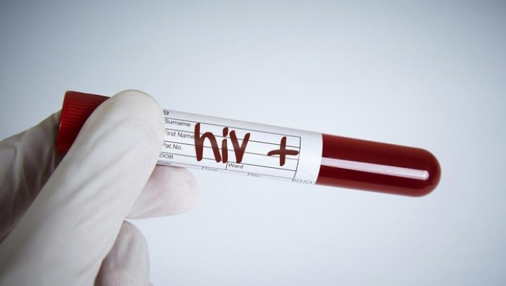 Sederet Jalur Penularan HIV yang Sering Terjadi, Bukan di Kolam Renang!  