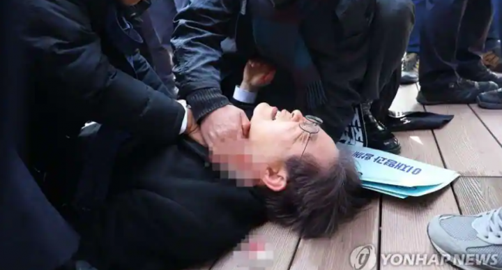 Foto-foto insiden itu menunjukkan pemimpin oposisi terbaring di tanah dengan mata tertutup, ketika orang-orang di sekitarnya menekan saputangan ke luka di sisi lehernya /Kantor Berita Yonhap-Agensi