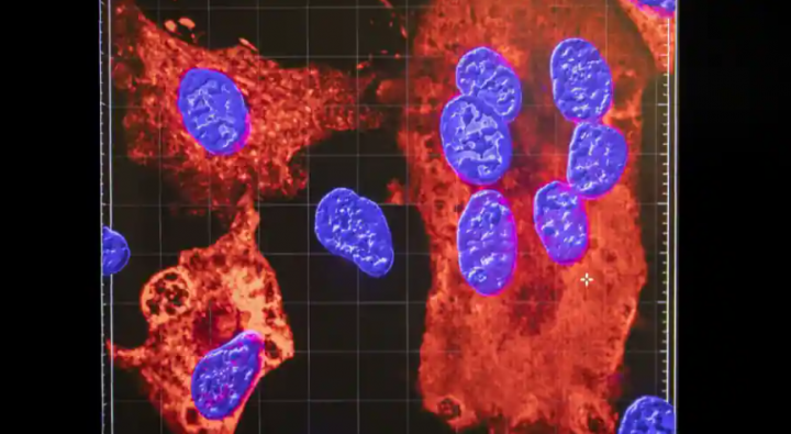 Gambar ini menunjukkan inti sel terinfeksi oleh SARS-CoV-2 /Sumber gambar: Gambar PA