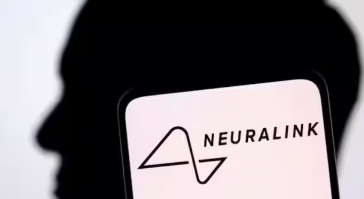 Uji Coba Manusia Terhadap Neuralink Elon Musk Temui Hambatan Saat Chip Otak Mulai Terlepas