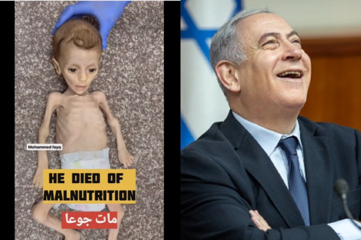 Memilukan! Bayi Gizi Buruk 7 Bulan di Gaza Harus Berakhir Akibat Israel Blokade Bantuan Masuk ke Rafah. (Collage by Riau24.com)