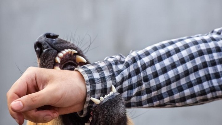 WHO Sebut Ada 71 Warga RI Meninggal gegara Rabies, Provinsi Ini Paling Terdampak