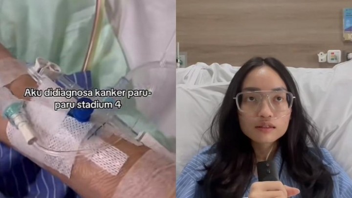 Wanita Jakbar Kena Kanker Paru Stadium 4 Meski Tak Merokok, Ini Kata Dokter Onkologi