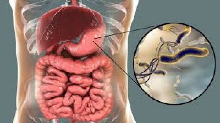 Cara Mencegah Terkena Virus Lambung Setelah Terpapar