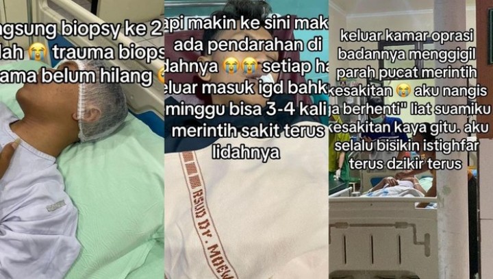 Dialami Pria Solo, Dokter Ungkap Gejala Kanker Lidah yang Muncul di Usia Muda