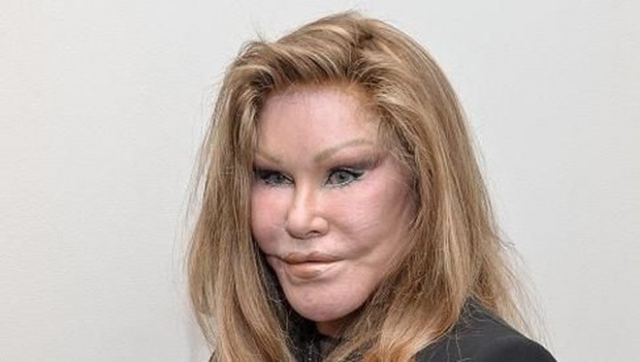 Sosialita Jocelyne Wildenstein Meninggal saat Tidur Siang, Apa Pemicunya?