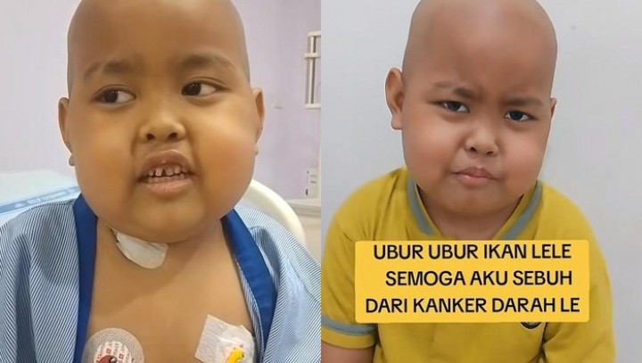 Cerita Ortu di Bogor soal Kebiasaan Makan Anaknya Sebelum Idap Kanker Darah