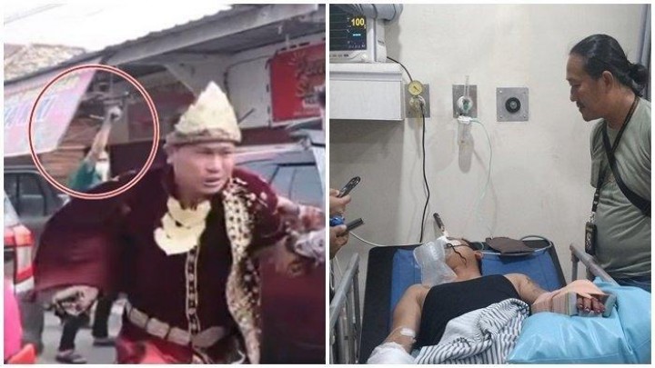 Heboh! Calon Pengantin Pria di Pelambang Tiba-tiba Dibacok saat Hendak Akad. (X/Foto)