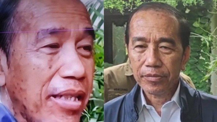 Ajudan Tegaskan Jokowi Alergi Kulit Biasa, Bantah Isu Sindrom Stevens-Johnson 