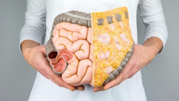 Fakta-fakta Kanker Organ Pencernaan Meningkat di Usia Muda, Waspadai Gejalanya