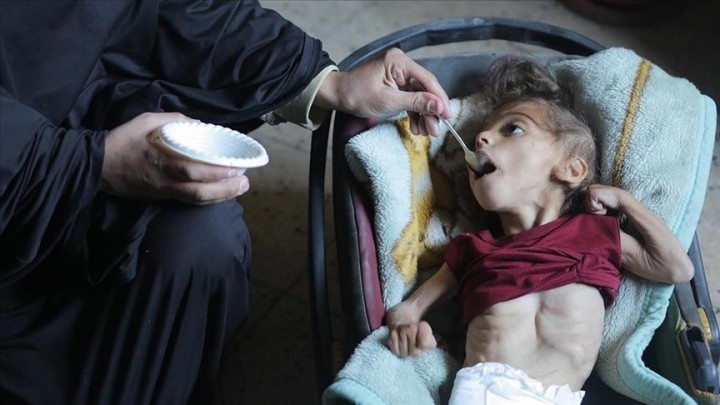 Realitas Hidup Anak-anak di Gaza: Kelaparan, Putus Sekolah dan Jadi Yatim Piatu