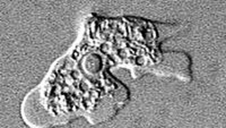 Dialami Bocah 9 Tahun, Infeksi Amoeba Pemakan Otak Picu Kematian 