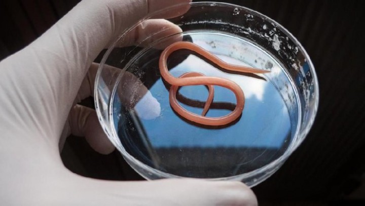 Kemenkes Buka Suara Terkait Balita di Sukabumi Meninggal gegara Kecacingan