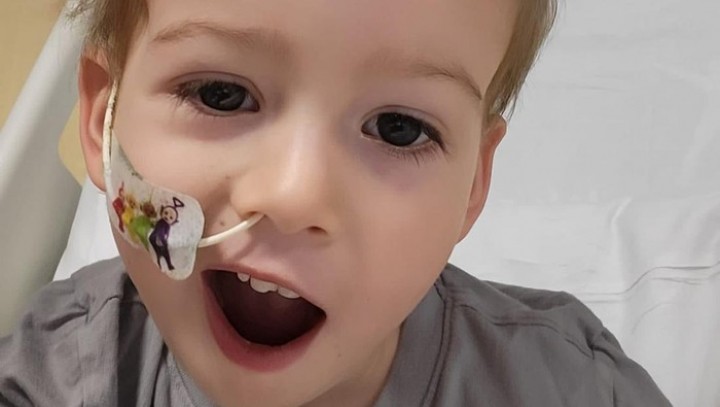 Awal Mula Bocah 2 Tahun Kena Stroke, Tiba-tiba Wajah Turun Sebelah