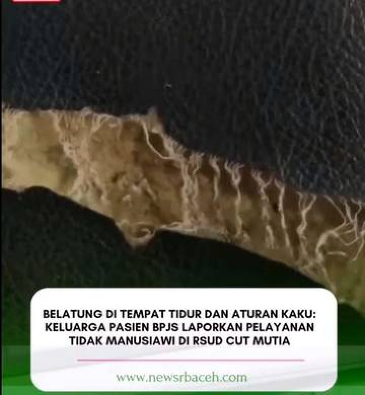 Kemenkes Tegur RSUD Cut Meutia Imbas Viral Bed Pasien Penuh Belatung
