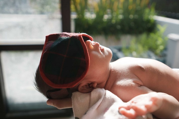 Cara Lindungi Kulit Anak yang Rentan Terbakar Matahari