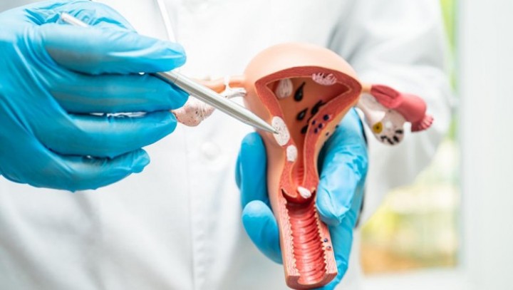 Cewek Perlu Tahu, Ini Masalah Tersembunyi di Rahim yang Bisa Ganggu Kesuburan